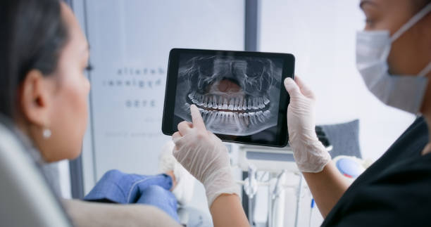 Licensed Teeth Whitening service in Moline, IL - Smile Center Dentistry